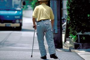 日本橋にあるクリニックのレーザー脱毛