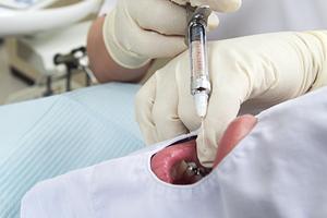 山形市内でクレアチニン検査の意味と信頼性の高い泌尿器科クリニックを徹底解説